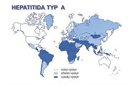 Hepatitida typ A