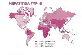 Hepatitida typ B